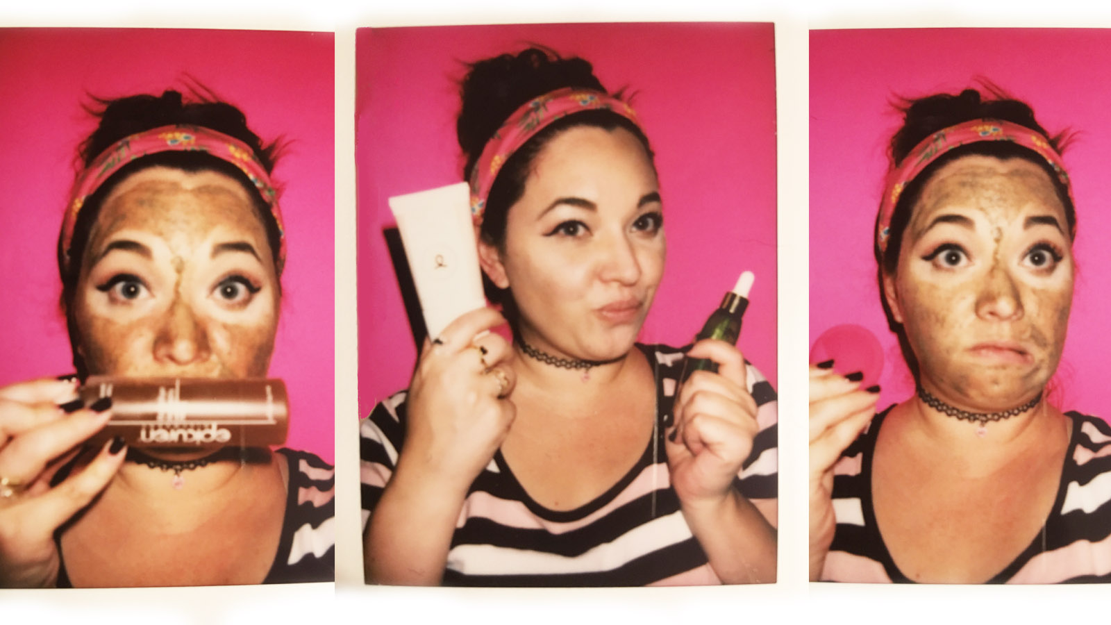 My acne was caused by a benzoyl peroxide allergy