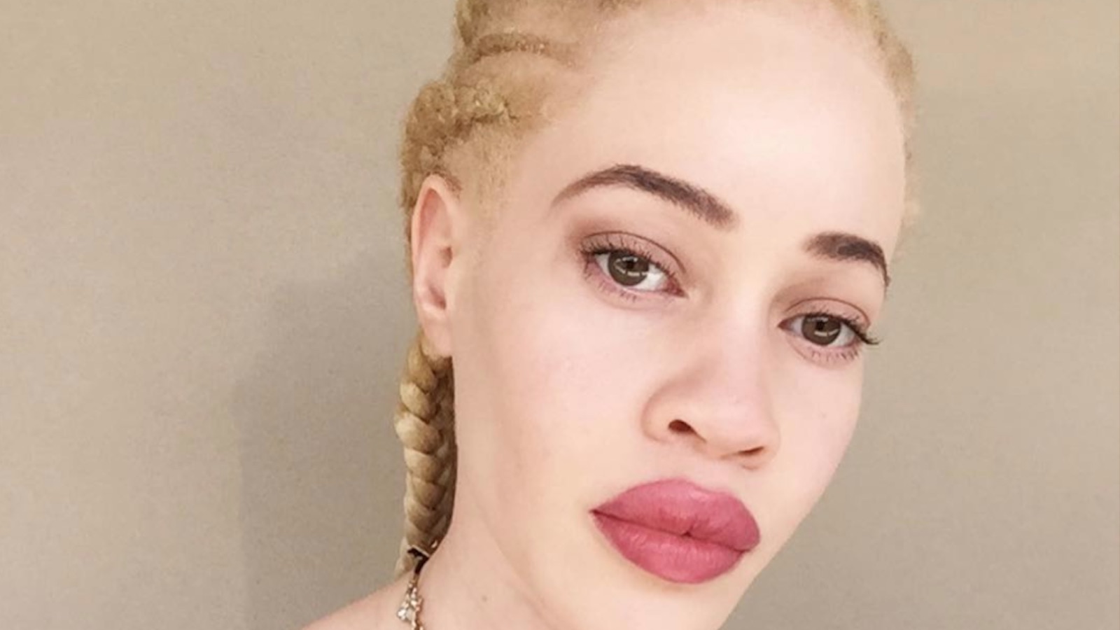 Wet N Wild Chose A Model With Albinism To Front Their Next