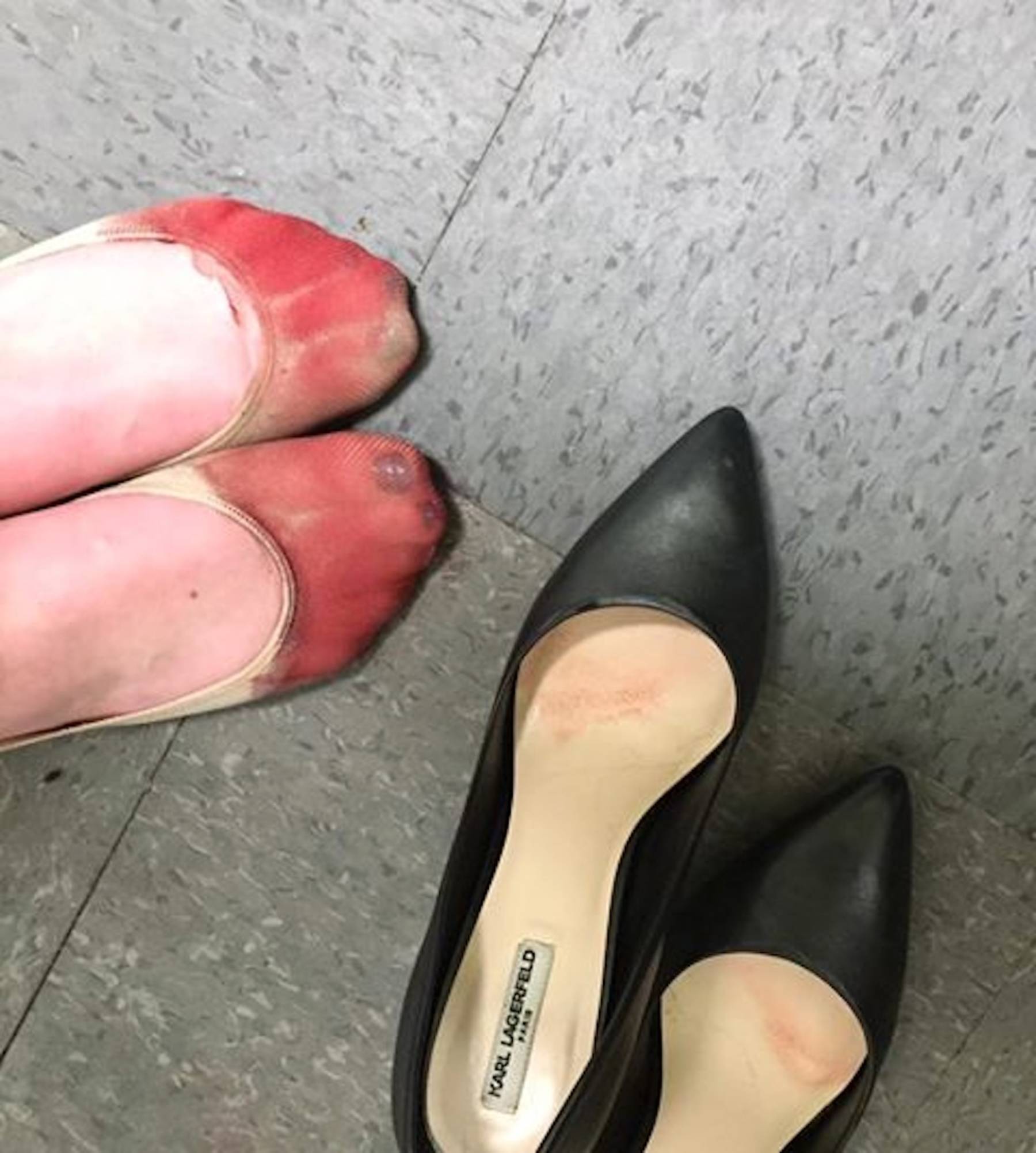 worst heels
